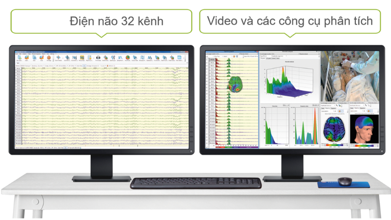 Giá bán Máy đo điện não đồ