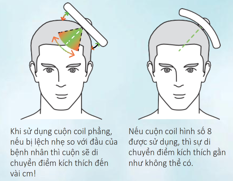 Kích thích từ trường xuyên sọ