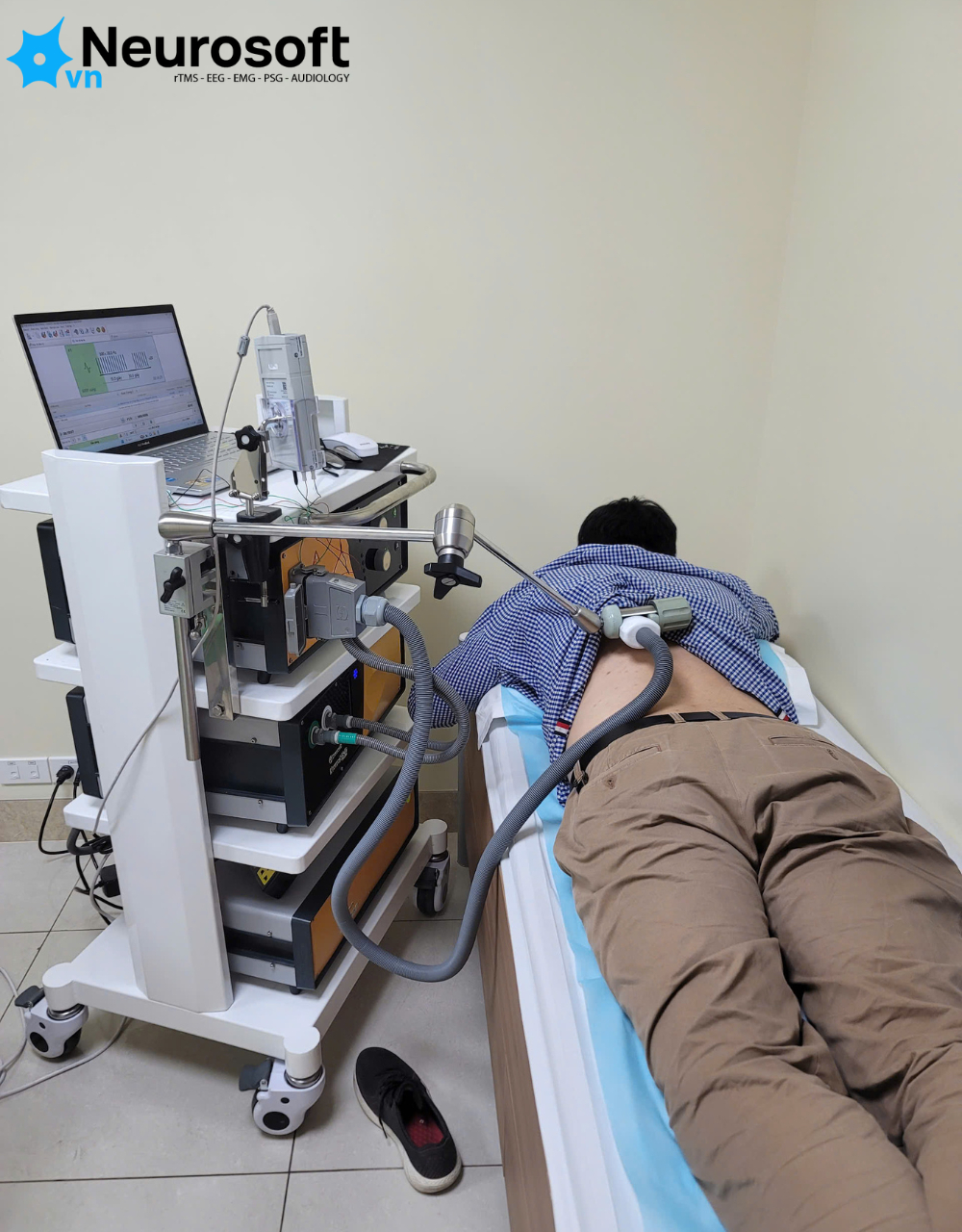 Kích thích từ xuyên sọ điều trị trầm cảm