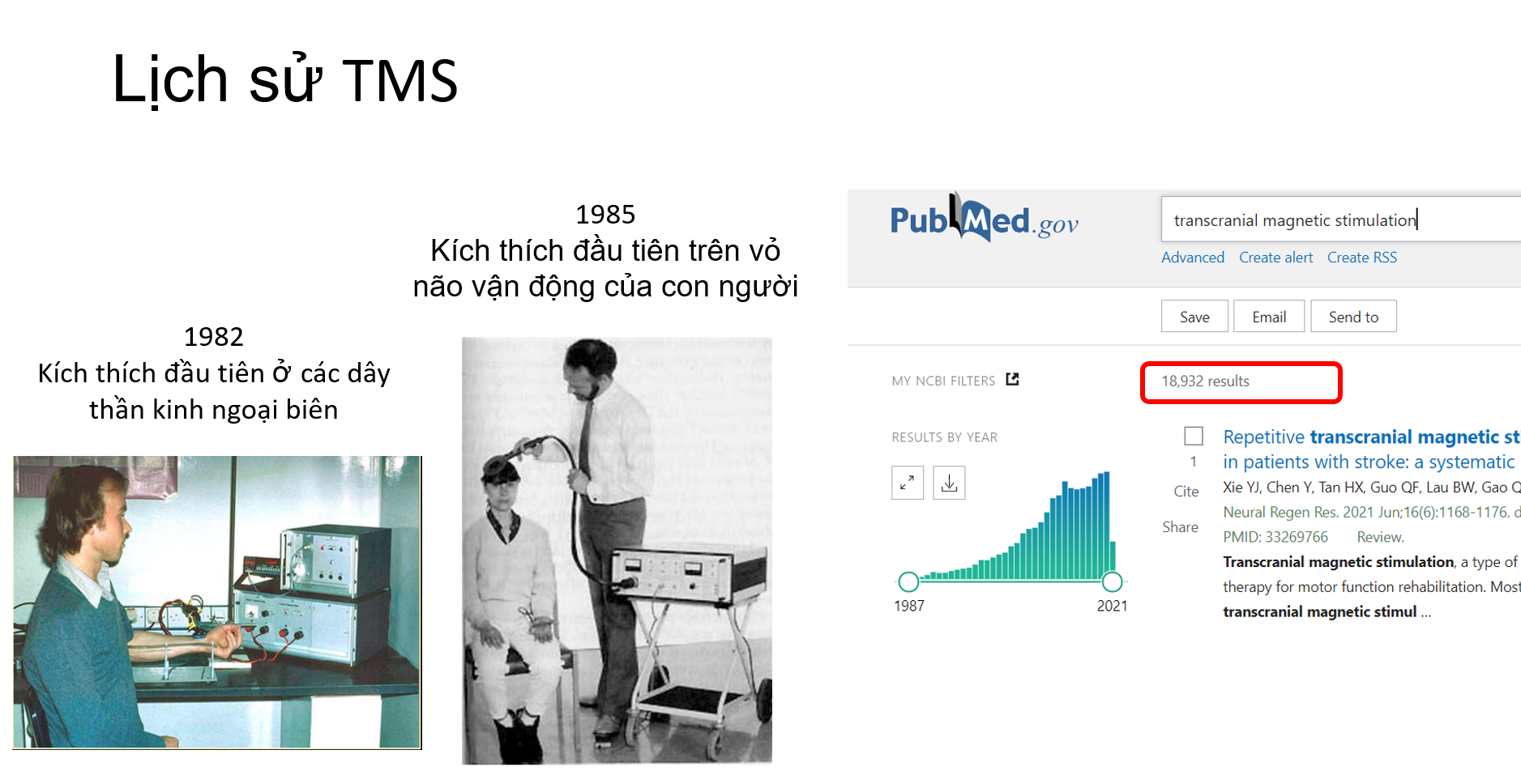 Kích thích từ trường xuyên sọ TMS